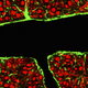 Illustration for article titled Breakthrough: Scientists Use Sound To Breach The Blood-Brain Barrier
